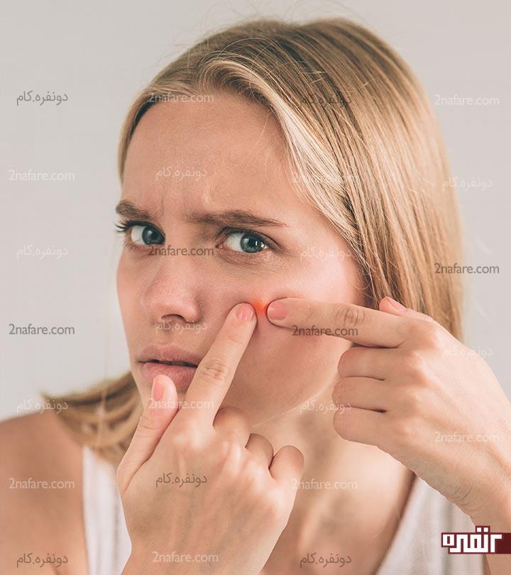 چه غذاهایی باعث ایجاد آکنه میشن؟ چه غذاهایی باعث ایجاد آکنه میشن؟