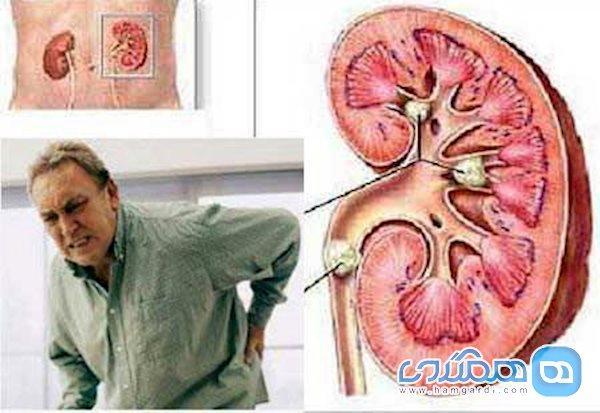 قاتل دیابت و سنگ کلیه از راه رسید قاتل دیابت و سنگ کلیه از راه رسید