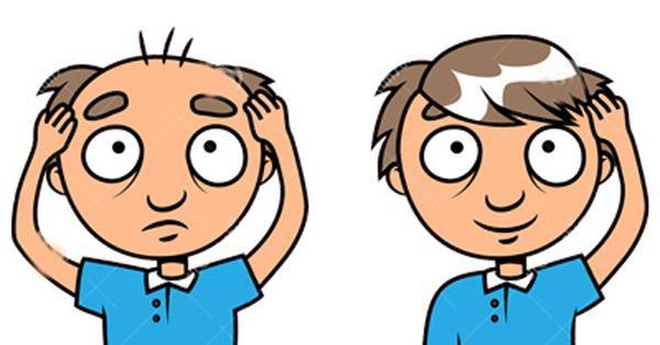ترمیم مو به روش HRT چگونه انجام می شود؟ ترمیم مو به روش HRT چگونه انجام می گردد؟