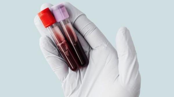 این آزمایش خون 14 نوع سرطان را قبل از توسعه تشخیص می دهد